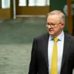 Anthony albanese